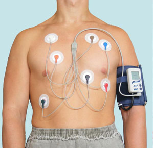 Blood pressure and ECG Holter monitoring